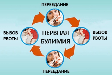 Лечение булимии в Краснокаменске